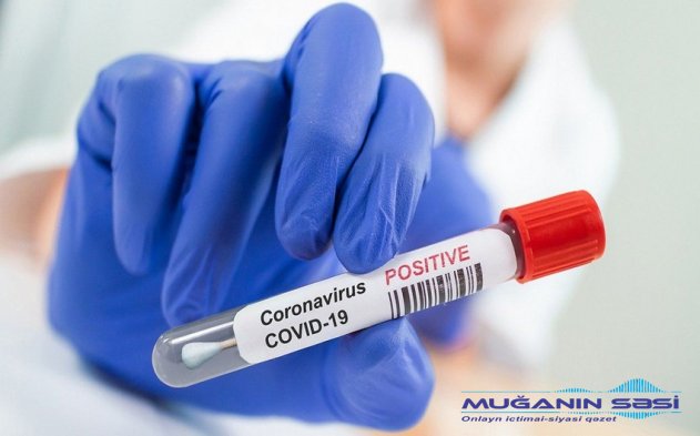 Azərbaycanda koronavirusa daha 2 414 yoluxma qeydə alınıb, 36 nəfər vəfat edib